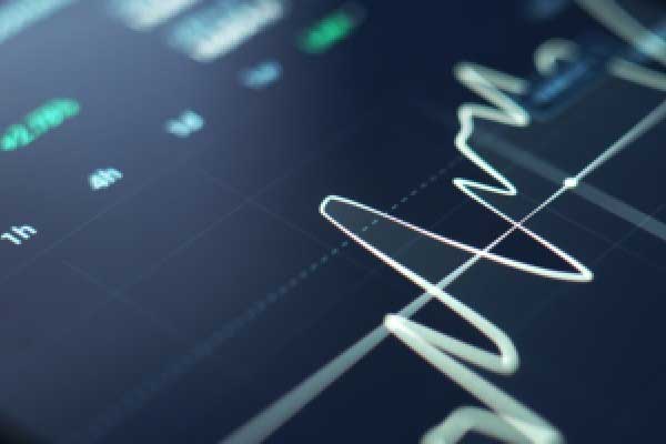 XM代理官网-英伟达(NVDA.US)重挫拖累大盘 纳指跌逾1% AI热潮下市场分化加剧